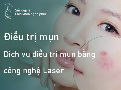 Điều trị mụn bằng công nghệ Laser